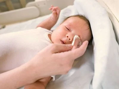 Conjuntivitis en bebés