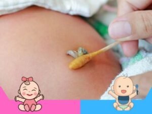 cordón umbilical infectado