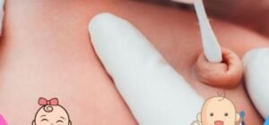 Limpieza del cordon umbilical