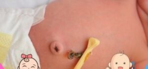 Cuando se cae el cordón umbilical