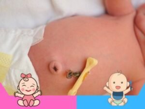 Cuando se cae el cordón umbilical